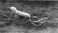 Helicobacter pylori elektronmikroszkópos felvételei